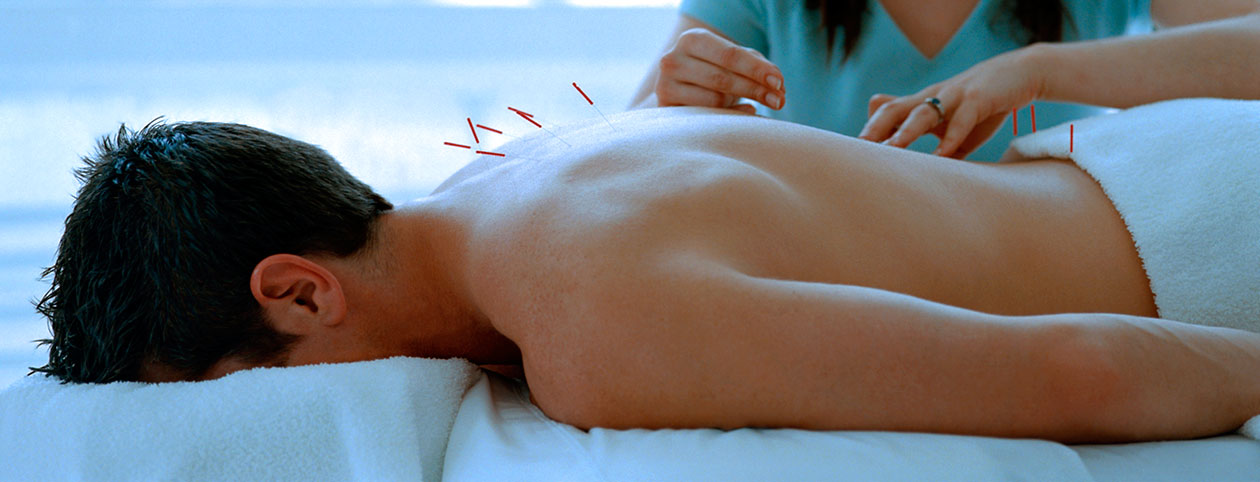 man-getting-acupuncture-vs-chiropractic-treatment